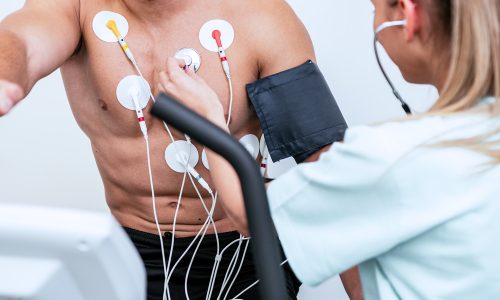 How to Prepare for a Cardiac Stress Test